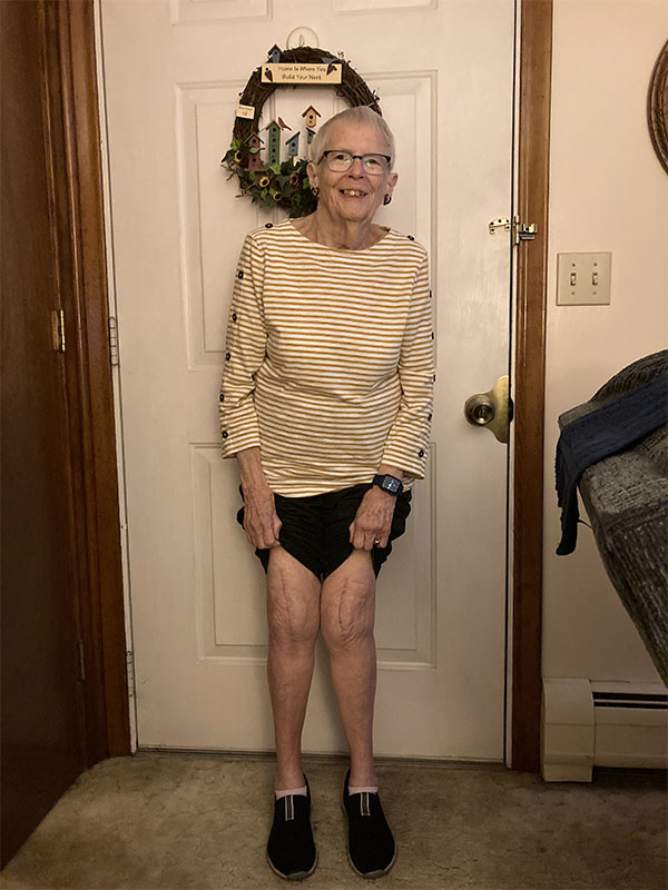Marilyn's Story