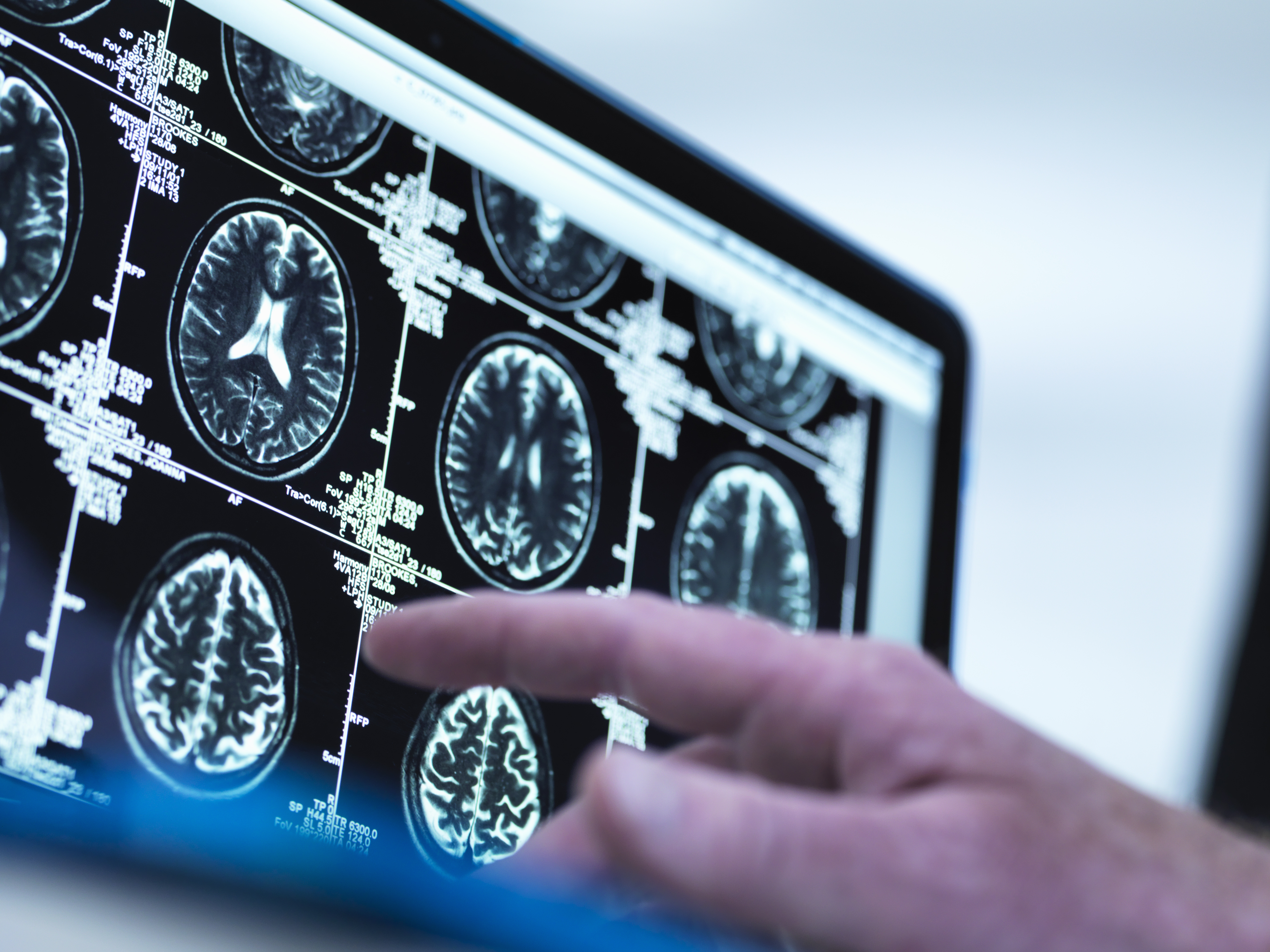 Trinity Health Of New England Headache Clinic - Hartford